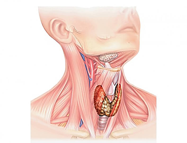 Зоб пищевода. Щитовидная железа и мышцы шеи.